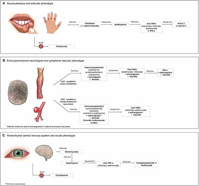 Treating the Different Phenotypes of Behçet's Syndrome